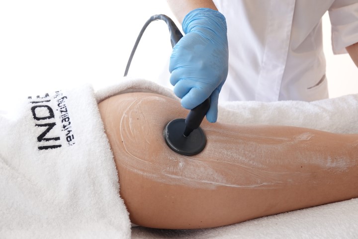 INDIBA CORPORAL: Remodelación Corporal, Flacidez y Celulitis