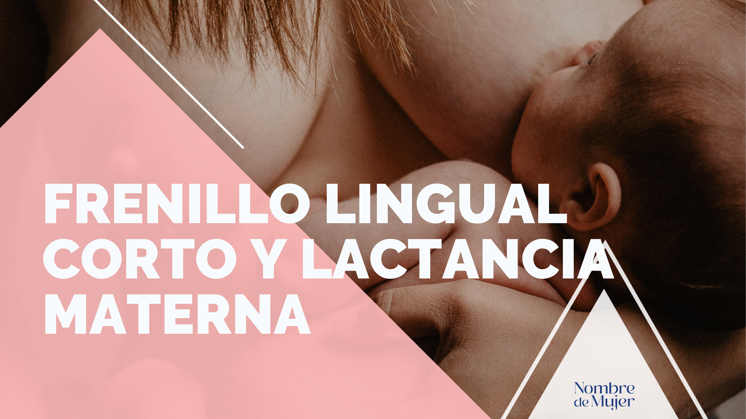 frenillo lingual corto y lactancia materna